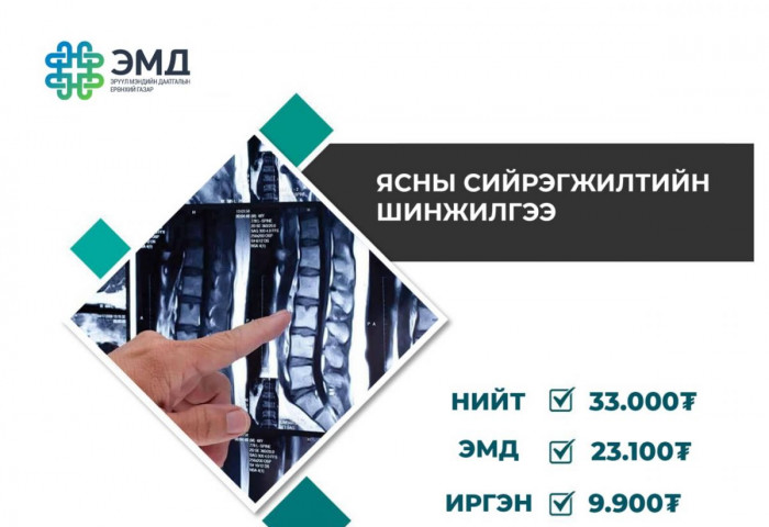Ясны сийрэгжилтийн шинжилгээний 70 хувийг ЭМД-ын сангаас хөнгөлнө