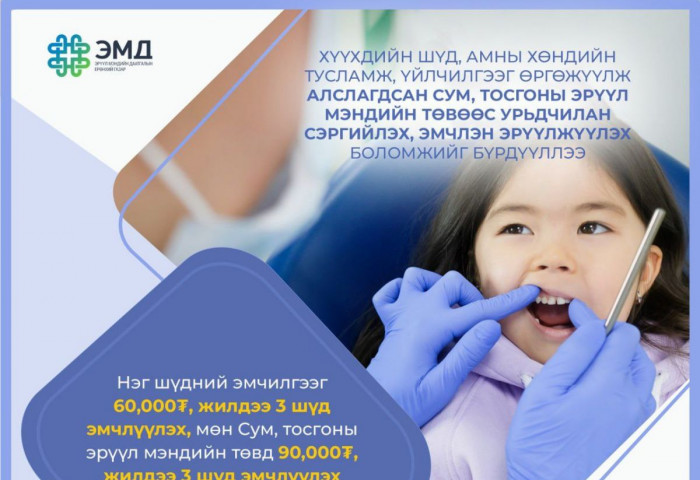 Нэг шүдний эмчилгээг 60 мянган төгрөгөөр тооцож, жилдээ 3 шүд эмчлүүлэх зардлыг ЭМДС-гаас санхүүжүүлэхээр болов