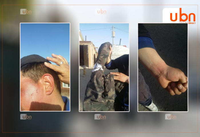 ИРГЭН А.МААМХҮҮ: Хөгжлийн бэрхшээлтэй хүүг минь 3 том Казак залуу гар хөлийг нь мяндсаар уяж байгаад бэлчээр дээр зодож танхайрсан