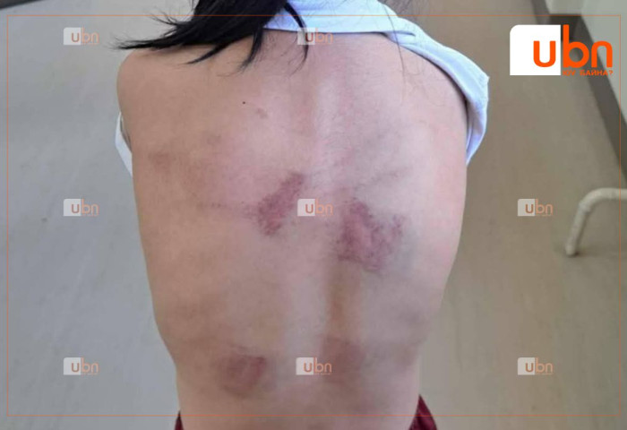 ТОДРУУЛГА: Хоёрдугаар ангийн охиноо зодсон аавыг цагдаагаас шалгаж байгаа бөгөөд охиныг хамгаалалтад авчээ