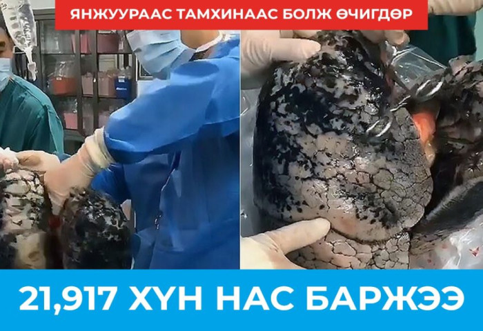 Янжуур тамхинаас болж 21917 хүн нас баржээ