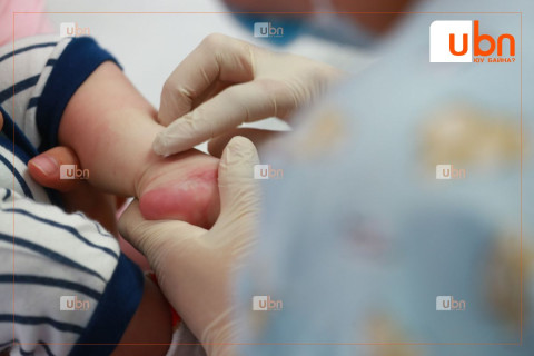 ХӨСҮТ: Улаанбурханы халдвараар өвчилсөн 4 сартай хүүхэд өнөөдөр үүрээр ЭНДСЭН