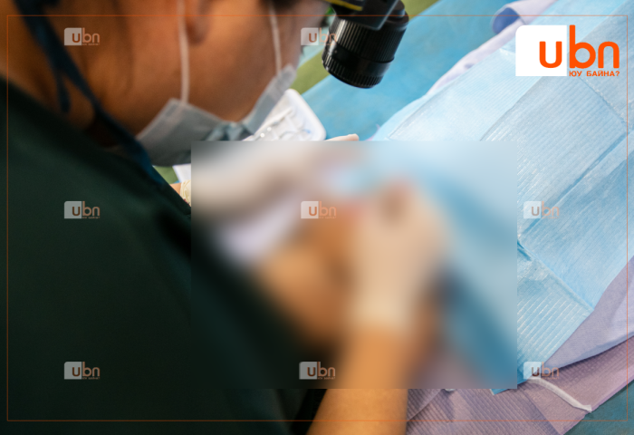 ЭРТ ИЛРҮҮЛЭГ: Судалгаагаар 0-17 насны хүүхдийн дунд шүд цооролт 78 хувийг эзэлж байна