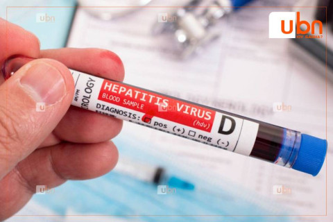 ЭМЯ: Шивээс хийлгэхдээ ариун багаж хэрэгсэл, нэг удаагийн зүү тариур хэрэглээгүйгээс  В, С, D вирусийн халдвар авна