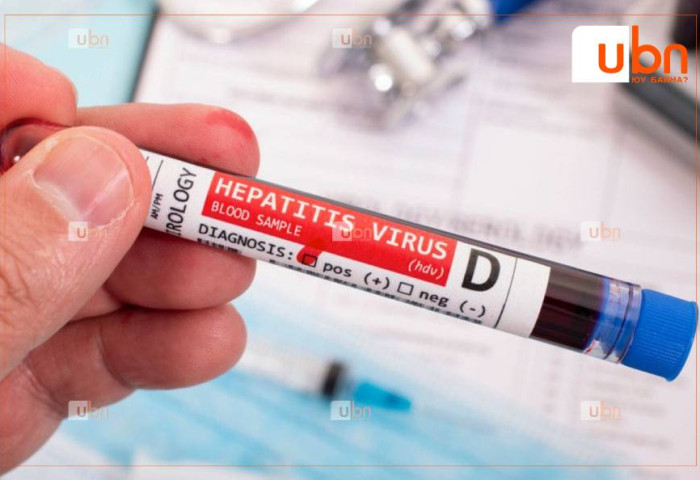 ЭМЯ: Шивээс хийлгэхдээ ариун багаж хэрэгсэл, нэг удаагийн зүү тариур хэрэглээгүйгээс  В, С, D вирусийн халдвар авна