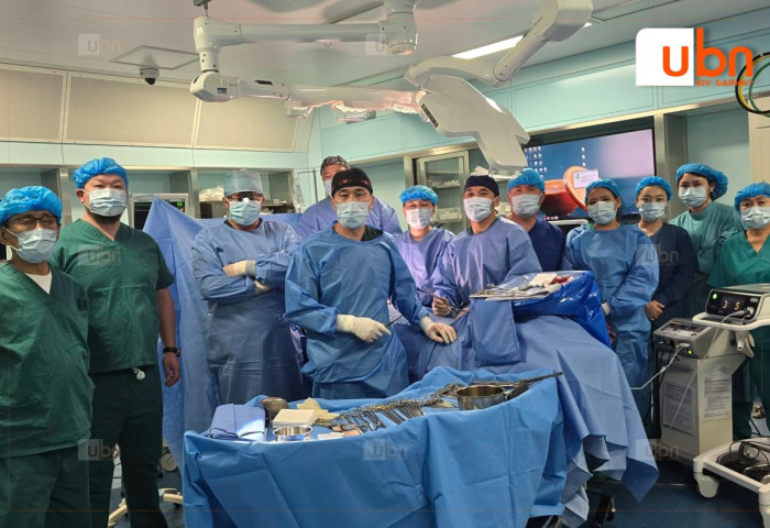 Хавдрын дэд төв элэг тайрах анхны мэс заслаа амжилттай хийлээ