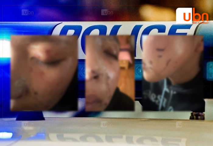 Нэгнийхээ нүүрийг улаан, эрээн болтол нь маажсан сурагчийг шалгаж, маажуулсан охиныг хамгаалах байранд хүргэжээ